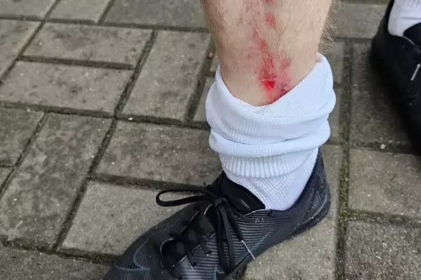 Eine Niederlage, die schmerzt: 1764973150-1763405046=1568104